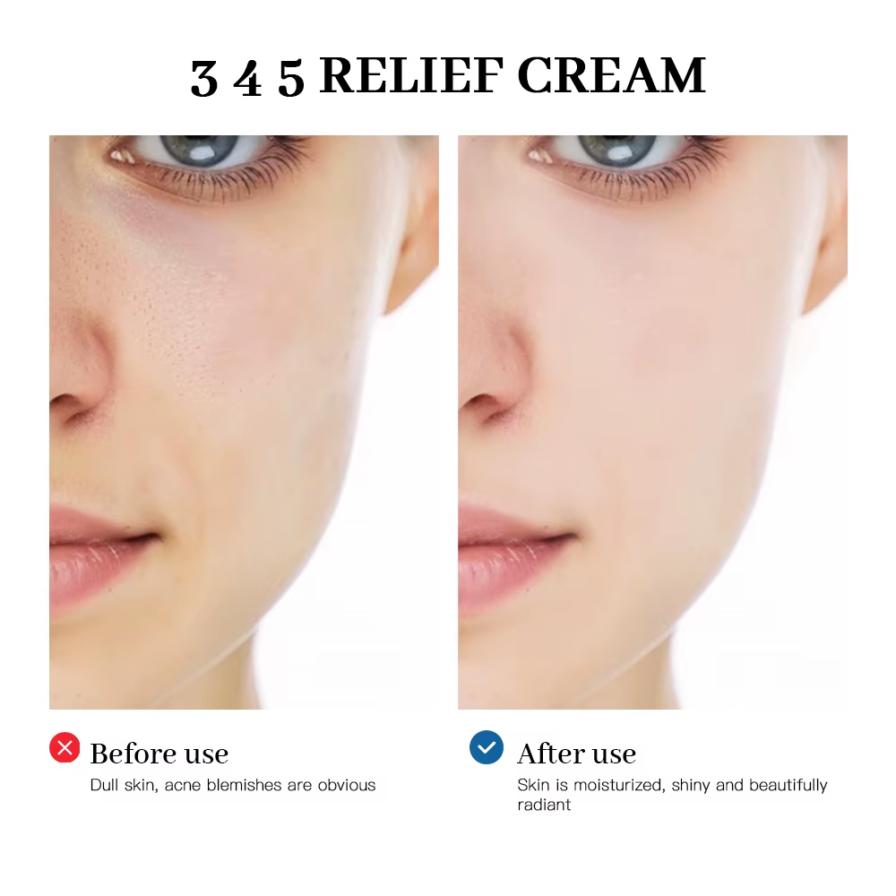 345 Relief Cream Comprehensive Solution to Skin Problems Anti-Sugar and Antioxidant Brightening Skin Improving Acne Marks Moistu